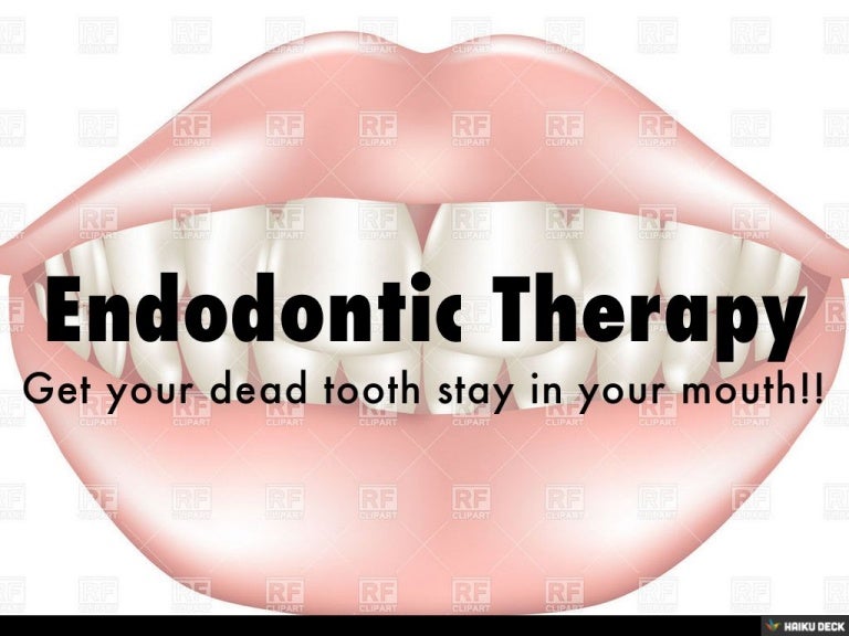 Endodontic Therapy