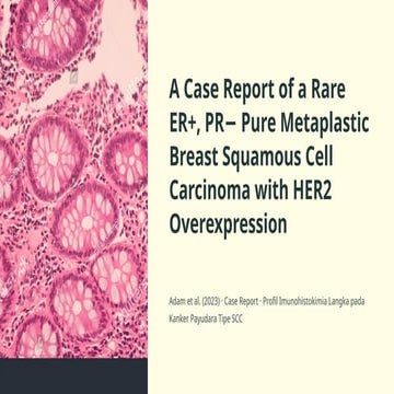 case report breast cancer pure metaplastic breast squamous cell ...