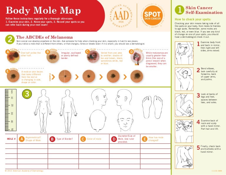 American Academy of Dermatology's Body Mole Map