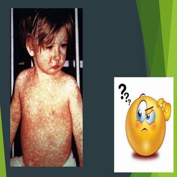 MEASLES - soon to be eradicated ..!!