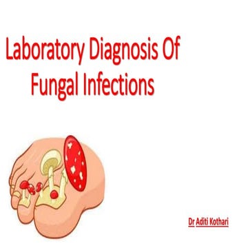 laboratory diagnosis of fungal inections