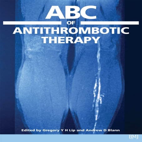 Abc of antithrombotic therapy