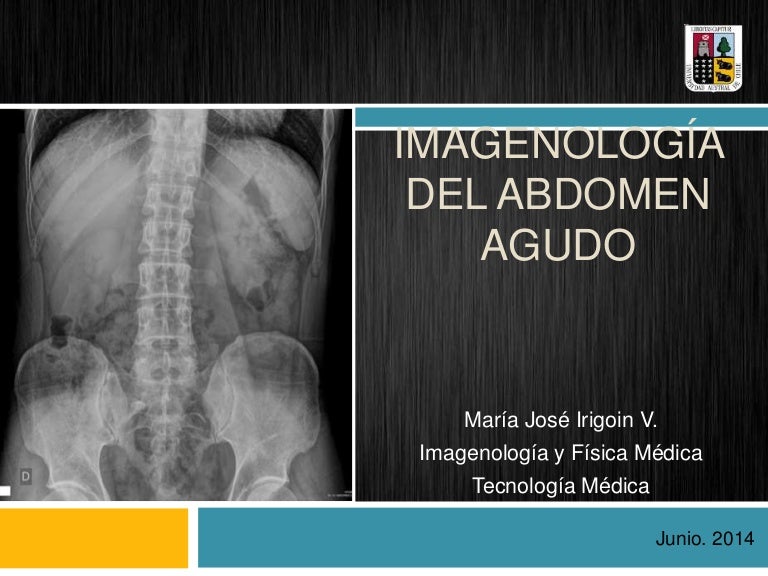 Imagenología del abdomen agudo