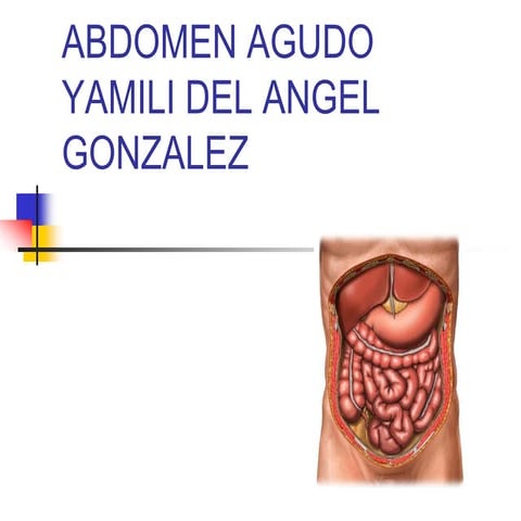 Abdomen agudo