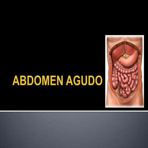 Abdomen agudo  alma viri