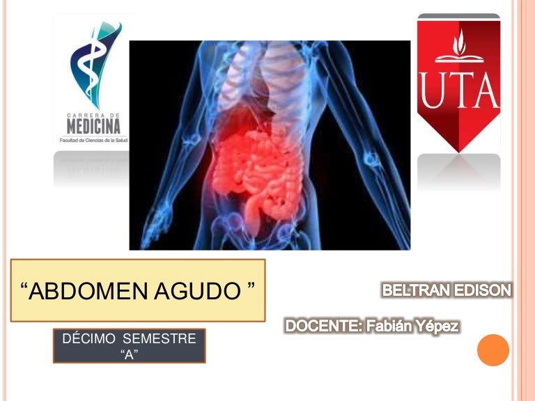 Abdomen agudo presentación cuadro clínico