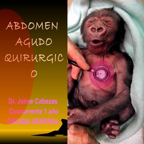 Abdomen agudo quirurgico