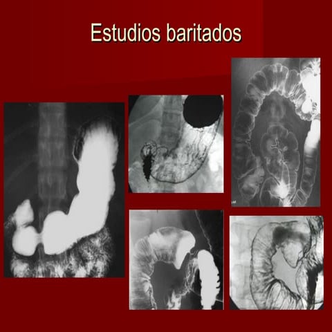 Abdomen ii | PPT