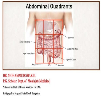 Abdomimal pain  ppt