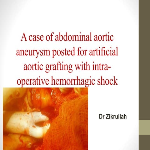 a case of abdominal aorta aneurysm-- AAA