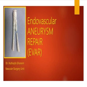 Endovascular Aortic Aneurysm Repair | PPTX