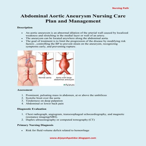 Abdominal Aortic Aneurysm Nursing Care Plan and Management