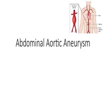 Abdominal Aortic aneurysm intro till management .pptx