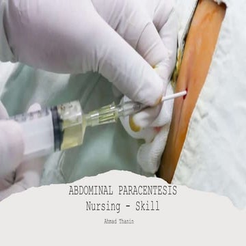 Abdominal Paracentesis - Nursing Role