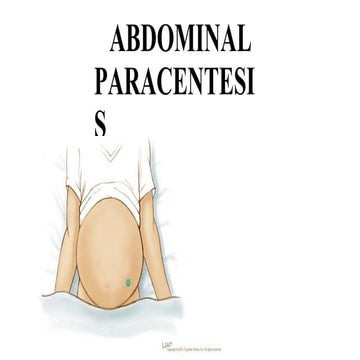 Abdominal Paracentesis.pptx read hdhdh sbg