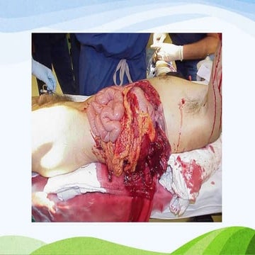 Abdominal trauma