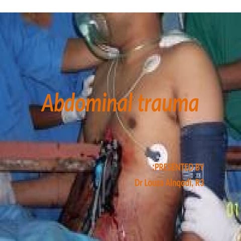 Abdominal trauma--.pptAbdominal trauma--.ppt