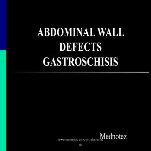 abdominal wall defect | PPTX