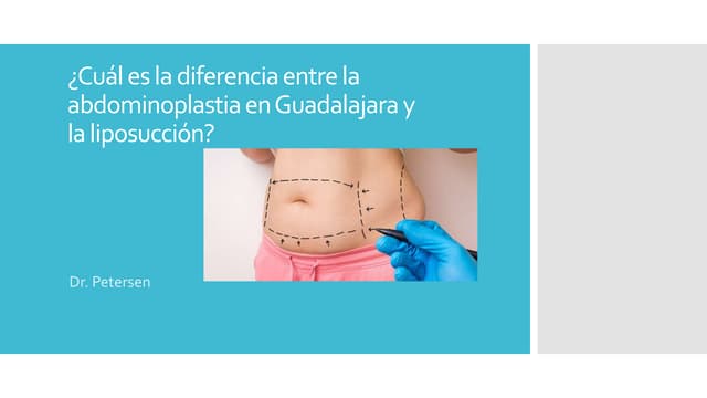 ¿Cuál es la diferencia entre la abdominoplastía en Guadalajara y la liposucción?