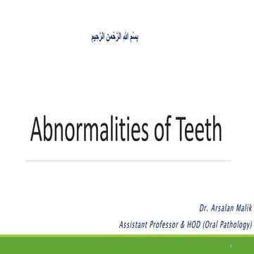 Abnormalities of teeth