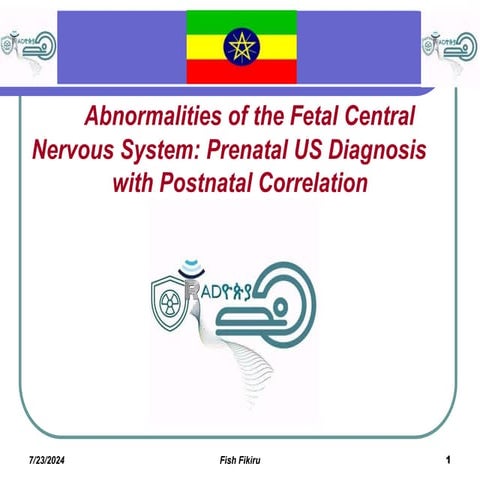 Abnormalities of the Fetal Central Nervous System Prenatal US Diagnosis with ...