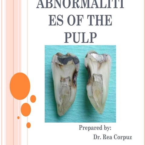 Abnormalities of the pulp | PPT