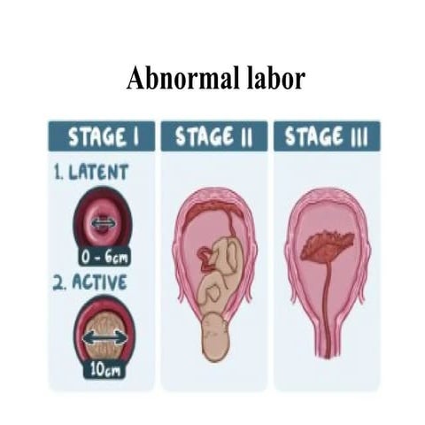 abnormal labor  for midwifery students pptx