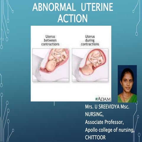 Abnormal uterine action