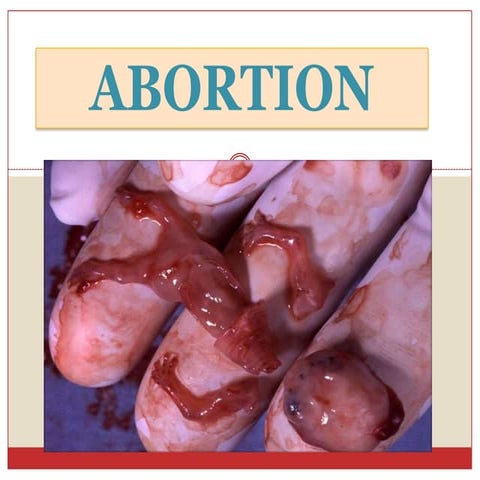 Abortion