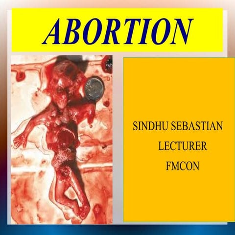 Abortion.ppt for 2nd msc
