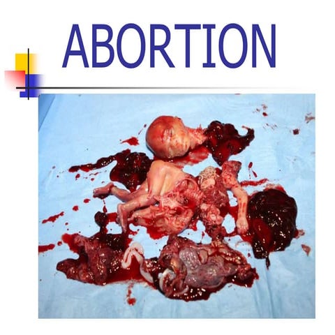 Abortion - Presented By Mohammed Haroon Rashid 
