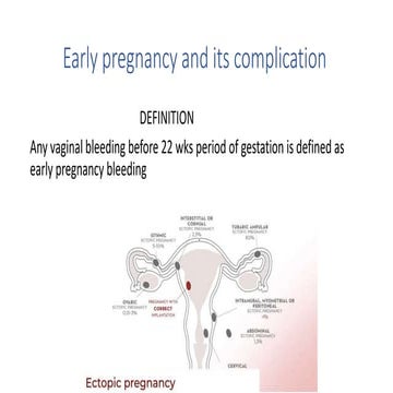 abortion.pptx iwqjefnhka ka x ;kj coknaCNADS OI