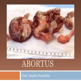 PPT Abortus