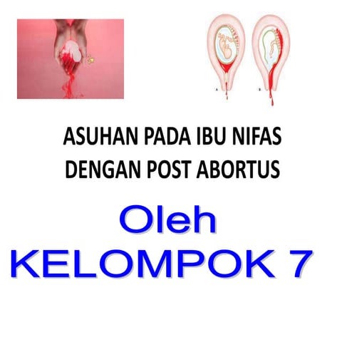 Abortus ppt.ppt