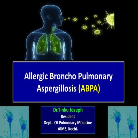 Allergic Broncho Pulmonary Aspergillosis (ABPA) by Dr.Tinku Joseph