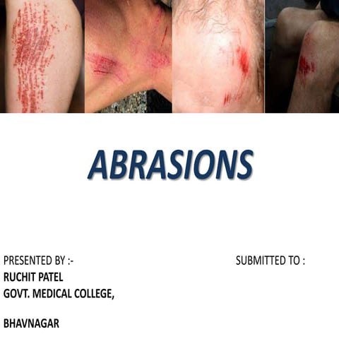 Abrasions