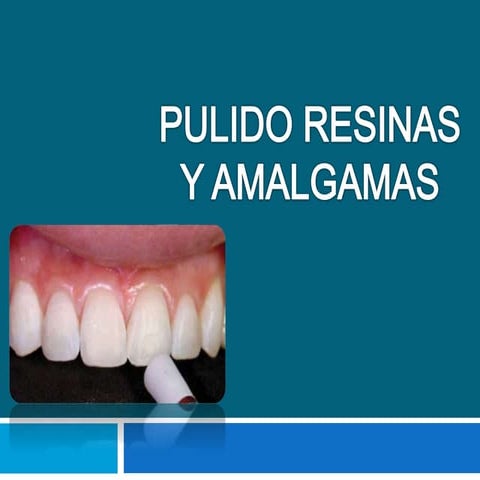 Resinas y Amalgamas