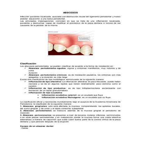 Abscesos | DOCX