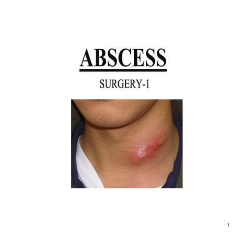 Abscess and its types, treatment . SINUS and its types