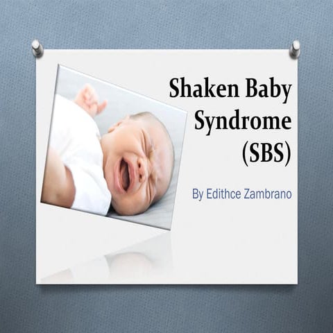 PowerPoint-example03-Shaken Baby