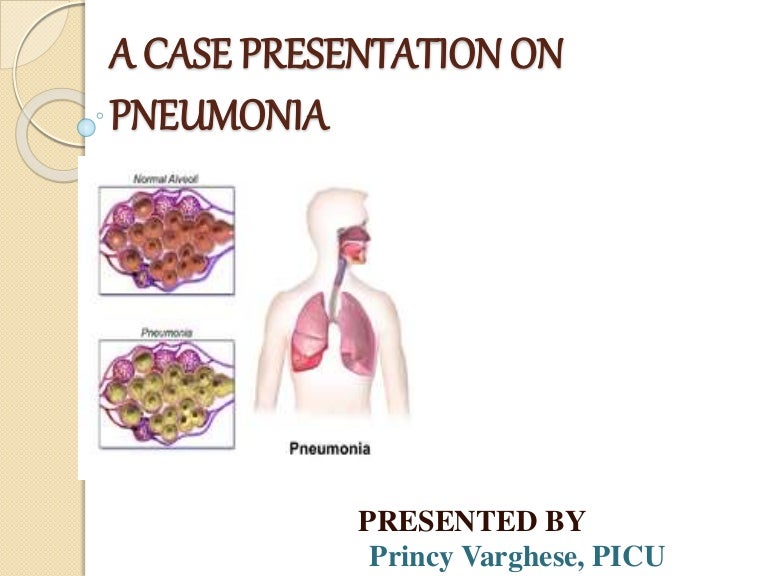 A case presentation on pneumonia
