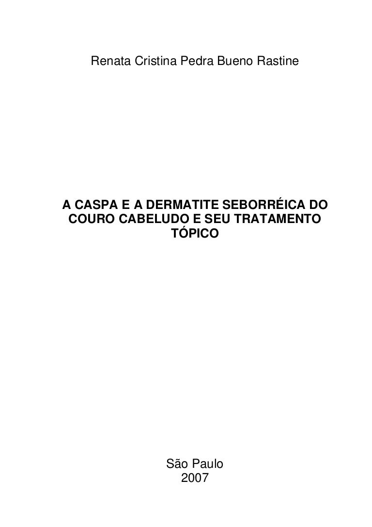 A Caspa E A Dermatite Seborreica Do Couro Cabeludo E Seu Tratamento T