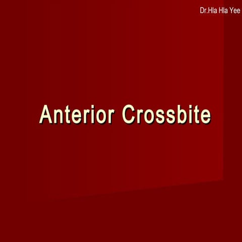 Anterior Crossbite