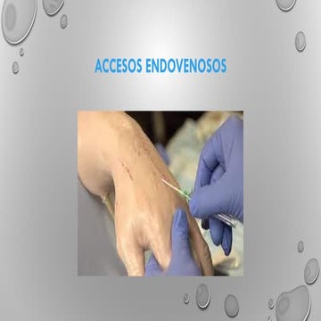 Guia para un acceso endovenoso enfermeri