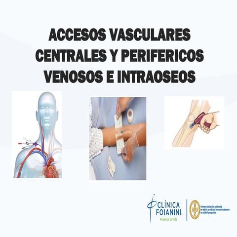 ACCESOS VASCULARES - centrsles, perifericos, intraoseos.pptx