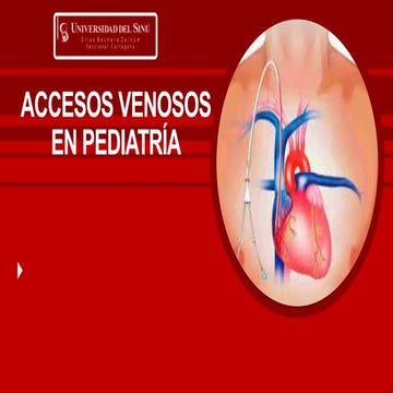Accesos venosos