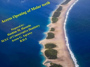 Access opening of molar teeth