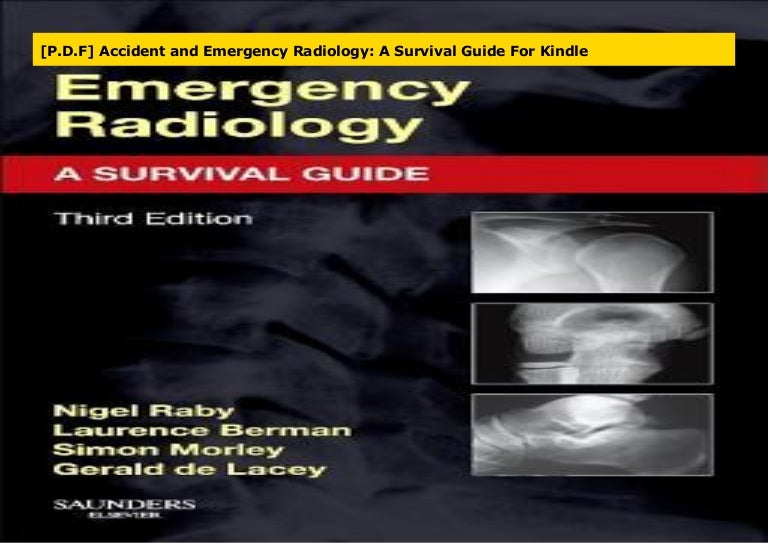 [P.D.F] Accident and Emergency Radiology A Survival Guide For Kindle
