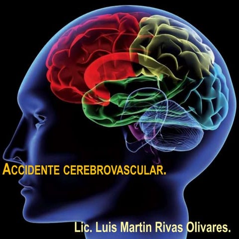 Accidente cerebrovascular