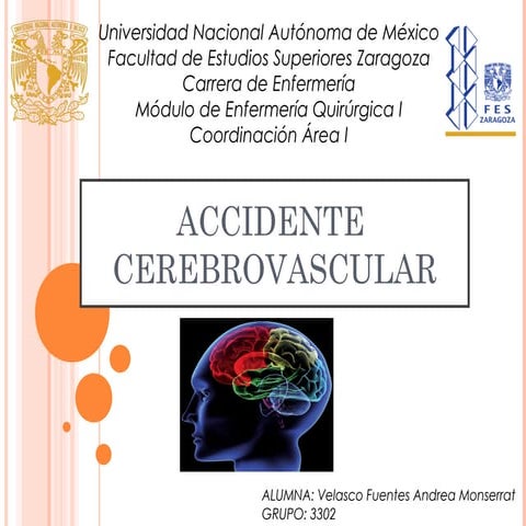 Accidente cerebrovascular